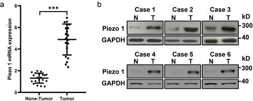 Figure 1. Piezo1 is upregulated in human OC tissues. (a) Analyses of Piezo1 mRNA expression, and (b) protein expression by Western blot in human primary OC tissues and adjacent non-tumor tissues. Data were expressed as mean ± SD. ***p < 0.001.