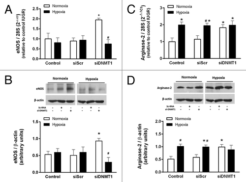 Figure 8. Effect of DNMT1 silencing on the response to hypoxia in IUGR-HUVEC. Quantification of eNOS (mRNA, A; protein, B) and arginase-2 (mRNA, C; protein, D) levels in IUGR-HUVEC exposed to normoxia (5% oxygen, open bars, n = 5) or hypoxia (2% oxygen, solid bars, n = 5) in basal conditions (control), or in the presence of an unspecific siRNA (siScr) and a siRNA against DNA methyltransferase-1 (siDNMT1). mRNA levels are expressed as 2-ΔΔCT referred to control condition in normoxia. Values are mean ± SEM *p < 0.05 vs. control, #p < 0.05 vs. corresponding condition in normoxia, two-way ANOVA.