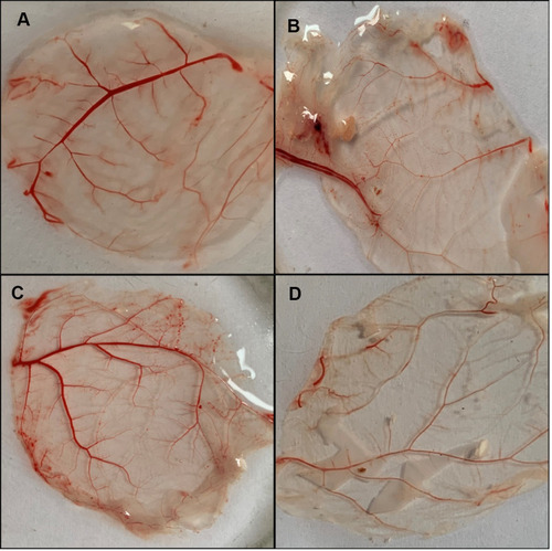 Figure 12 Analysis of Neovascularization of CAM in the presence of HeLa cells upon treatment with SeNp. Embroyonated eggs (11 days old) were inoculated into CAM with HeLa cells in the presence or absence of SeNp and incubated for 3 days at 37 °C. At 3 days, eggs were harvested and changes in angiogenesis in CAM were observed in (A) untreated; (B) HeLa cells (C) when only SeNPs (positive control) were inoculated and (D) when the cells were inoculated in presence of 100μg/mL selenium nanoparticles concentration.