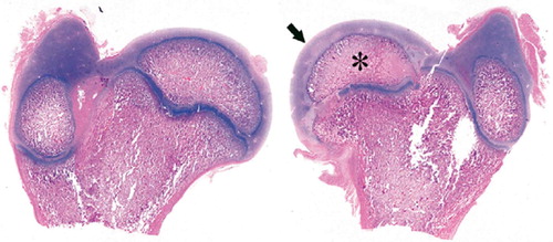 Figure 1. Histological specimen of right (Rt) and left (Lt) femurs extracted from a piglet killed at postoperative week 4.The left femoral head (Lt) showed avascular necrosis of the capital femoral epiphysis.Marked reduction in size of ossific nucleus (*) and considerable hyperplasia of articular cartilage (arrow) were seen in the operated femur. (Hematoxylin and eosin, ×1).