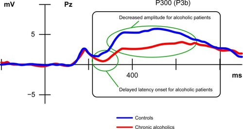 Figure 2 Illustration of a disturbed P300 (P3b) component resulting from the comparison of alcoholic patients with healthy matched controls.
