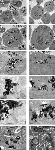 Figure 8 Transmission electron microscopic images showing the cellular uptake of CeO2 NPs (A–F) and Au/CeO2 NPs (G–L) by A549 cells after 48 hours of incubationNotes: (A, B) Cellular uptake of CeO2 NPs. (G, H) Cellular uptake of Au/CeO2 NPs. (C, I) Nanoparticle localization in cytoplasmic matrix outside the nucleus. (D, J) Nanoparticle agglomeration inside the cell is shown as black arrows. (E, K) Individual nanoparticles still seen inside the cell is shown as black arrows. (F, L) mitochondrial damage due to oxidative stress induced by ROS is shown as white arrows.Abbreviations: cy, cytoplasmic matrix; Au, gold; CeO2, cerium oxide; Au/CeO2, gold-coated cerium oxide; NPs, nanoparticles; nu, nucleus.