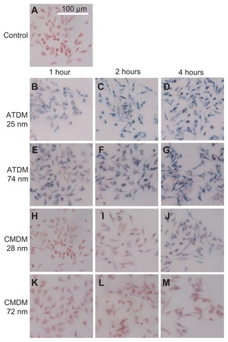 Figure 2 SPIO/USPIO labeled macrophage cells. Microscopy images of labeled cells by ATDM and CMDM. Iron particles are stained blue, and RAW264 macrophage cell are stained red. (A) Unlabeled control cells; (B) ATDM 28 nm labeled cells at 1 h administration; (C) ATDM 28 nm labeled cells at 2 h administration; (D) ATDM 28 nm labeled cells at 4 h administration; (E) ATDM 74 nm labeled cells at 1 h administration; (F) ATDM 74 nm labeled cells at 2 h administration; (G) ATDM 74 nm labeled cells at 4 h administration; (H) CMDM 28 nm labeled cells at 1 h administration; (I) CMDM 28 nm labeled cells at 2 h administration; (J) CMDM 28 nm labeled cells at 4 h administration; (K) CMDM 72 nm labeled cells at 1 h administration; (L) CMDM 72 nm labeled cells at 2 h administration; (M) CMDM 72 nm labeled cells at 4 h administration.Abbreviations: SPIO, superparamagnetic iron oxide; USPIO, ultrasmall superparamagnetic iron oxide; ATDM, alkali-treated dextran magnetite; CMDM, carboxymethyl dextran magnetite.