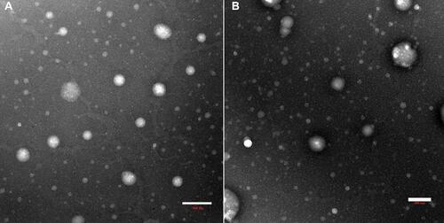Figure 4 Transmission electron micrographs of F1 (A) and F1-IG2 (B) formulations.