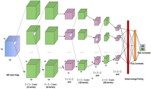 Figure 1. Proposed 3-dimensional convolutional neural network (volumetric-ConvNet) for Alzheimer’s detection.