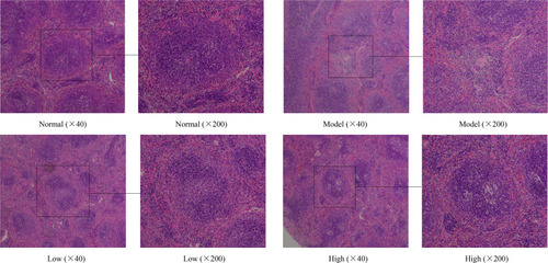 Figure 5 Effects of Lactobacillus plantarum KSFY06 on spleen morphology of injured mice. Model: group induced by D-Gal/LPS (250 mg/kg·bw, 25 mg/kg·bw); Low: treated with LP-KSFY06 (2.5×109 CFU/kg·bw); High: treated with LP-KSFY06 (2.5×1010 CFU/kg·bw).