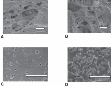 Figure 2 (A) 200 × SEM image of unetched PLGA scaffold showing micropores and a nano-smooth surface (Scale bar = 100 μm). (B) 200 × SEM image of NaOH etched PLGA showing micropores and a nano-rough surface (Scale bar = 100 μm). (C) 5000 × SEM image of unetched PLGA showing micron sized pores and a nano-smooth surface (Scale bar = 10 μm). (D) 5000 X SEM image of PLGA showing a nano-rough surface (Scale bar = 10 μm).