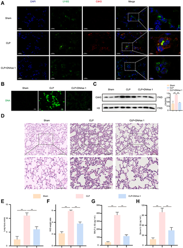 Figure 1 Elevated IL-1β and NETosis were observed in sepsis-induced lung injuries. After DNAse 1 was administered intraperitoneally for 24 hour, the mice were subjected to CLP for 24 h (n = 6). The sham group was used as a control. Then, the mice were sacrificed, and lung tissues were collected for further analysis. (A). Representative confocal images of Ly6G (green) and CitH3 (red) immunofluorescent staining revealed NETs formation in lung tissues samples. DAPI (blue) was used to stain the cell nuclei. Scale bars, 15 μm and 5 μm. (B). NETs associated DNA components were stained with SYTOX Green. Scale bar, 20 µm. (C). CitH3 protein expression levels were detected by Western blot in tissue lysate. H3 was regarded as a reference protein. (D and E). Representative images of haematoxylin and eosin staining-stained lung tissues and lung injury score from indicated groups. Scale bars, 50 μm and 100 μm. (F). Pulmonary edema was evaluated by the lung W/D ratio. (G and H). ELISA was used to measure the BALF and serum IL-1β in mice. For all experiments, data are presented as the mean ± SD, one-way ANOVA was used for statistical analysis, **P < 0.01.