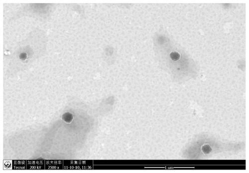 Figure 1 Transmission electron microscopy of CUR-NLCs.Note: Magnification: 2500×.Abbreviation: CUR-NLCs, curcumin nanostructured lipid carriers.