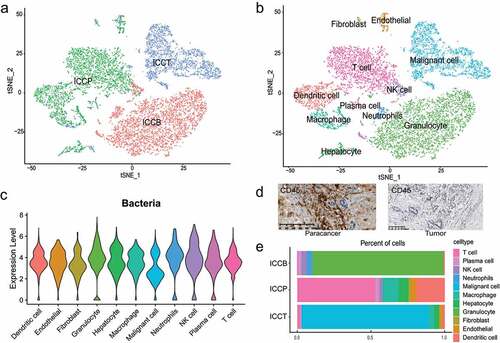 Figure 3. scRNA-seq analysis reveals the presence of bacterial RNA in each cell type. (a) t-SNE plot showing cell origins by color. (b) t-SNE plot showing cell clusters including fibroblasts, endothelial cells, malignant cells, hepatocytes, granulocytes, neutrophils, dendritic cells, macrophages, NK cells, plasma cells and T cells. (c) Violin plot showing the levels of bacterial RNA content in each cell type. The RNA content is reflected by sequencing reads count. (d) CD45 immunohistochemical staining shows an increased abundance of immune cells in the paracancerous tissue. (e) The proportion of cell counts of each cell type in each sample. B, plasma; P, paracancerous tissue; T, tumor tissue.