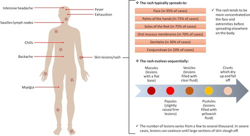 Figure 4. Common symptoms of MPX according to the WHO [Citation160] (Created with BioRender.com).
