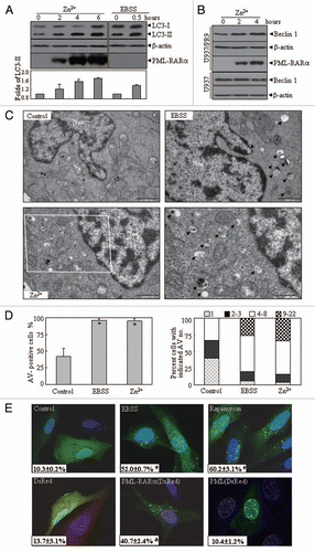 Figure 1 The effect of the ectopic expression of PML-RARα on autophagic activity in leukemic and nonleukemic cells. (A and B) U937/PR9 (A) and indicated cells (B) were respectively treated with or without 100 µM ZnsO4, or with EBSS for the indicated hours. Cell lysates were harvested for immunoblotting proteins as indicated. LC3-II protein expression was quantified according to the densitometric value and the relative folds against untreated cells were shown as means ± SD from three independent tests. (C) TEM micrographs of the indicated treatments in U937/PR9 cells. AV-like structures were indicated by arrowheads. “Nuc” stands for nucleus. The scale bars on control, EBSS- and Zn2+-treated cells were 1,000 nm. The high-magnification picture (right part of bottom row) was from the framed area in the Zn2+-treated cell (scale bar = 500 nm). (D) Quantification of data in part (C). The percentage of AV+ cells was shown in the left part and among these AV+ cells, the percentage of cells with indicated AV numbers per AV+ cell were indicated in the right part. The symbol *indicates a p value of less than 0.05 against U937/PR9 control cells. (E) U2Os cells were transfected with GFP-LC3 alone (top row) or co-transfected with GFP-LC3 and DsRed-PML-RARα, DsRed-PML or DsRed vector (bottom row). After 24 h, cells were examined by confocal microscopy. The representative images of the indicated transfected cells with the corresponding treatments were shown. The values (x ± SD) represent the percentage of GFP-LC3 puncta-positive cells from three independent experiments. The symbols * and # respectively indicated p values of less than 0.001 and 0.01 compared with the untreated cells with GFP-LC3 transfection alone. The symbol & indicated a p value of less than 0.05 compared with the cells co-transfected with DsRed and GFP-LC3 plasmids. All experiments were repeated at least three times and similar results were obtained.