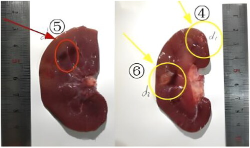 Figure 3. Damage caused by FUAS in the kidney tissues of the #2 live goat (yellow arrow: coagulation necrosis, red arrow: congestion).