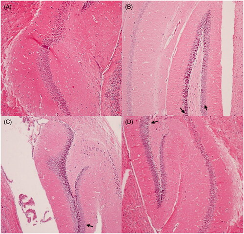 Figure 7. Protective effects of M. nigra against d-galactose induced cell loss in the hippocampus of mice revealed by hematoxylin and eosin (H&E, ×100) staining. (A) Control group: the neurons are full and arranged tightly, the nuclei are light stained; (B) d-galactose group: focal disappearance of neurons and red neurons, as the arrows pointed neurodegeneration was evident (neurons are shrunken, the nuclei are side moved and dark stained); (C) d-galactose + M. nigra 50 group: one red neuron observed; neurodegeneration reduced as the arrow marked; (D) d-galactose + M. nigra 100 group: one red neuron observed the neurons normalize, the nuclei are light stained and arranged tightly and neurodegeneration was attenuated significantly.