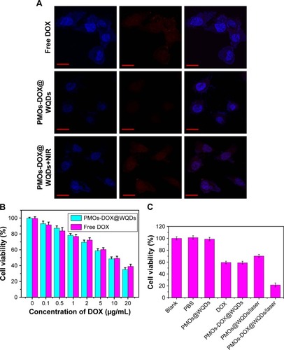 Figure 7 (A) CLSM of the HCT-116 cells after 8 h incubation with free DOX, PMOs-DOX@WQDs only, PMOs@WQDs with laser irradiation and PMOs-DOX@WQDs with laser irradiation (relative DOX concentration: 10 μg/mL) Scale bar: 50 μm; magnification: ×40. (B) Cell viability of HCT-116 cells incubated with different concentrations of DOX and PMOs-DOX@WQDs (equivalent concentration of DOX). (C) Cell viability of HCT-116 after 8 h incubation with PBS, free DOX, PMOs@WQDs, and PMOs-DOX@WQDs suspensions (DOX: 5.0 μg/mL) with and without NIR irradiation.