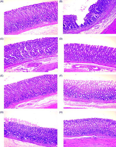 Figure 1. Rat gastric mucosa. (A, E) Normal gastric mucosa in Control group 1 and 2 rats, respectively. (B) Deep ulceration with sloughing of tissue till the basal gland in INDO rat. (C) Healing of mucosa starting from the basal area of ulcer in ranitidine + INDO rat. (D) Healing of mucosa starting from the basal area of the ulcer in fluoxetine + INDO rat. (F) Superficial ulceration that does not involve whole thickness of mucosa, with mononuclear cell infiltration in alcohol-only rat. (G) Mild superficial ulceration with mononuclear cells infiltration in ranitidine + alcohol rat. (H) Healing from basal ulcer in fluoxetine + alcohol rat. Representative photo-micrographs from each group are shown. (H&E; magnification = 40×).