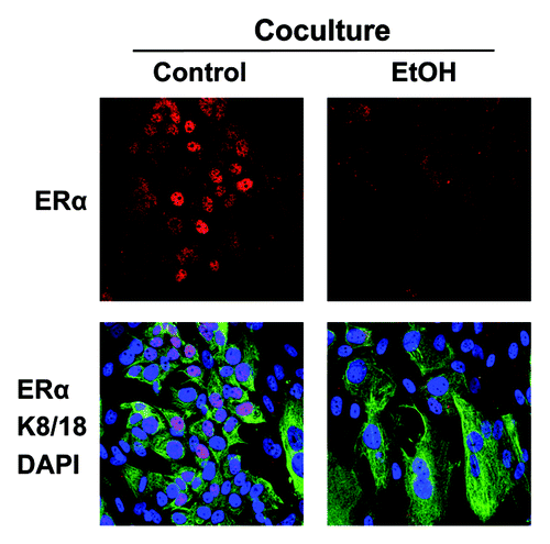 Figure 9. Ethanol suppresses the expression of ERα in MCF7 cancer cells. MCF7 cell-fibroblast co-cultures were treated with 100 mM EtOH for 72 h. Cells were fixed and immunostained with antibody probes directed against ERα (red) and K8/18 (green). Nuclei were counterstained with DAPI (blue). The upper panels show ERα staining only (red). The bottom panels show also the K8/18 staining (green) to identify the MCF7 cell population. Note that ethanol suppresses the expression of ERα specifically in MCF7 cells, as compared with untreated cells. Original magnification, 40x.