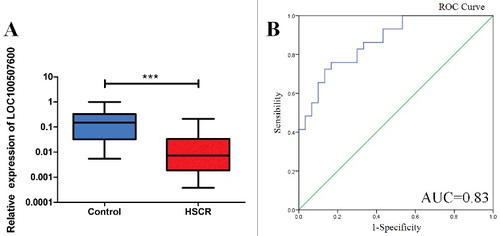 Figure 1. LOC100507600 is down-regulated in HSCR. (A) The expression of LOC100507600 in HSCR tissues (n = 64) and control tissues (n = 64). LOC100507600 was significantly reduced in patient tissues compared with control tissues. (B): Receiver Operating Characteristic (ROC) curve for the LOC100507600 to distinguish HSCR cases from controls.