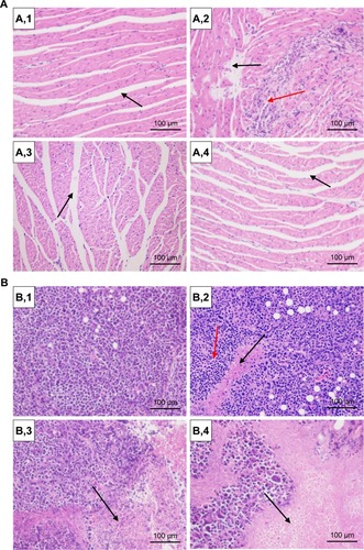 Figure 13 HE staining of (A) heart and (B) tumor (200× magnification).Notes: Heps tumor-bearing mice were randomly divided into four treatment groups and were administered with (1) normal saline, (2) free DOX, (3) DOX-BSA-NPs, and (4) DOX-BSA-V-NPs. Black arrow in (A,1), myocardial fibers arranged neatly; black arrow in (A,2), moderate focal edema necrosis; black arrow in (A,3) and (A,4), a slight extension of the myocardial fiber gap; red arrow in (A,2), focal band fibrosis; red arrow in (B,2), inflammatory infiltration; black arrow in (B,2), (B,3) and (B,4), cell apoptosis and spotty necrosis.Abbreviations: BSA, bovine serum albumin; DOX, doxorubicin; HE, hematoxylin and eosin; NPs, nanoparticles; V, vanillin.