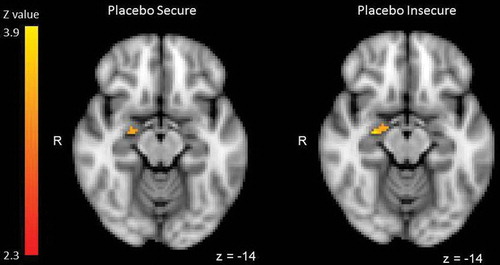 Figure 2. Right amygdala activation during infant crying (500, 700, 900 Hz) compared with control sounds (500, 700, 900 Hz) for individuals with secure and insecure attachment representations in the placebo condition. No significant amygdala activation was found in secure or insecure individuals in the oxytocin group.