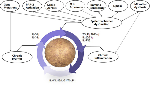 Figure 1 The pathogenesis of AD in the elderly that involves epidermal barrier dysfunction, chronic inflammation, and chronic pruritus.