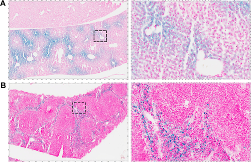Figure S3 Positive control Prussian blue staining for USPIO and counterstaining with nuclear fast red.Notes: (A) Mouse liver section, blue: USPIO; pink: nuclei, (B) Mouse spleen section, blue: USPIO; pink: nuclei.Abbreviation: USPIO, ultra-small superparamagnetic iron oxide.