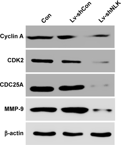 Figure 6 Downregulation of NLK affected cell cycle and migration regulatory proteins.