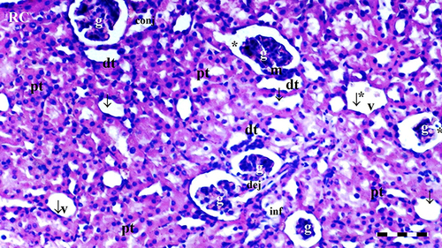 Figure 12 Representative light microscopy of kidney tissue from the DIR-S-FC60 group. Scale bar 50 µm, H&Ex100.