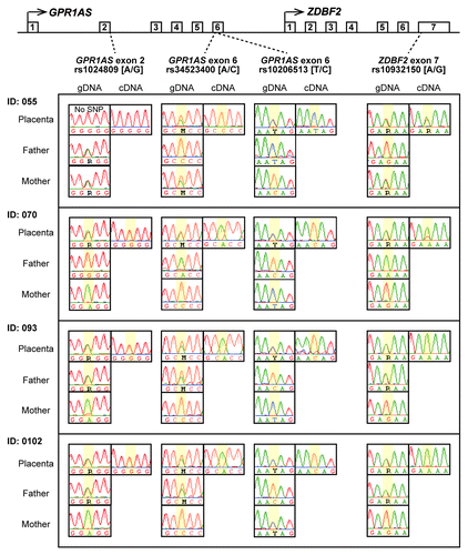 Figure 3. Allele-specific RT-PCR sequencing of GPR1AS and ZDBF2 in human placentas. Four heterozygous genotypes were used to distinguish between maternal and paternal alleles in human placental samples from four Japanese patients (National Center for Child Health and Development). SNP positions are highlighted in yellow.