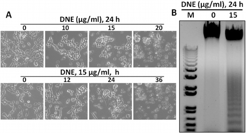 Figure 7. Morphological and apoptotic effects DNE in SH-SY5Y cells. (A) SH-SY5Y cells were grown in 24-well culture dishes to near confluence 50% and then starved in DMEM containing 0.5% FBS. After 24 h starvation cells were treated with 0–20 µg/ml of DNE in dose-dependent and 15 µg/ml of DNE in time-dependent experiments and morphology was observed by bright-field microscopy. (B) SH-SY5Y cells were grown in 100-mm culture dishes to near confluence 90% and then starved in DMEM containing 0.5% FBS for 24 h. The cells were then treated with 0 and 15 µg/ml of DNE. After 24 h DNE treatment, DNA was extracted and separated on 0.8% agarose gel containing ethidium bromide. DNA fragments were visualized under UV light. M indicates as a Marker.