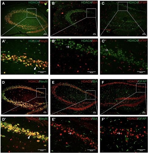 Figure 5 Neurons are a major source of HDAC4 and HDAC5 expression in the hippocampus. Colocalization of HDAC4 with NeuN (part A), IBA (part B), and GFAP (part C). Colocalization of HDAC5 with NeuN (part D), IBA (part E), and GFAP (part F). The colocalization is in yellow in the image. The arrowhead indicates double-labelled cells (part A'; part D'), the arrow shows the protein of interest that is not colocalized with the cell (part B'; part C'; part E'; part F'). The magnified image of the regions is marked with boxes. Scale bar = 100 mm.