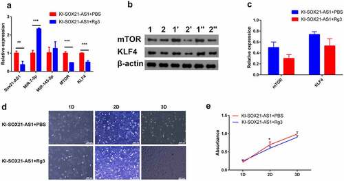 Figure 6. Ginsenoside Rg3 inhibits the proliferation of osteosarcoma cells by inhibiting the expression of SOX21-AS1.