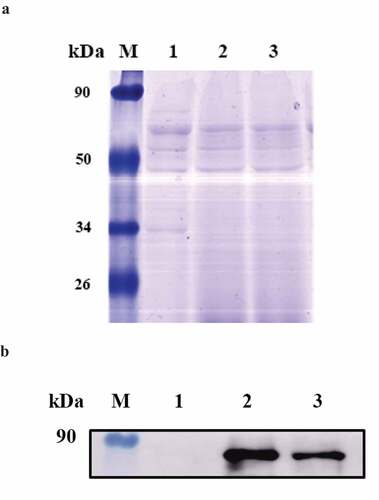 Figure 1. Characterization of the LM4Δhly::E7-1 strain