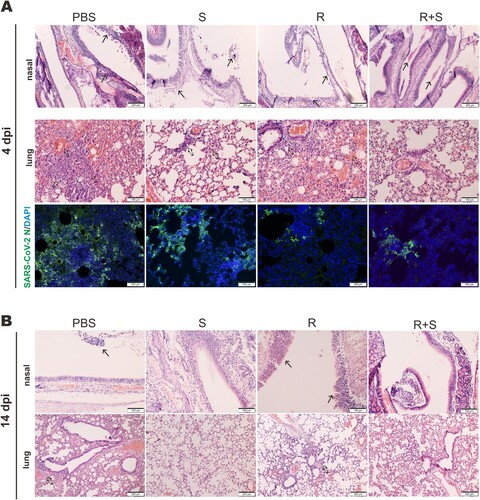 Figure 6. Effect of steroid and/or remdesivir on the histopathological changes in nasal turbinates and lungs of SARS-CoV-2-infected hamsters. Representative sections of the nasal turbinate and lung tissues from hamsters harvested at 4 dpi (A) and 14 dpi (B) were stained with hematoxylin and eosin. The arrows indicate inflammatory cell infiltration. Detection of SARS-CoV-2 N protein in lung tissue of SARS-CoV-2-infected hamsters treated with steroid (S) and/or remdesivir (R). SARS-CoV-2 N protein (green) was probed with rabbit anti-SARS-CoV-2 N antibodies followed by goat anti-rabbit antibodies conjugated to fluorescein. Nuclei were counterstained with DAPI (blue). Scale Bar = 100 μm for nasal turbinates; 200 μm for lungs.