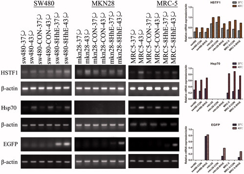Figure 4. RT-PCR analysis of HSTF1, Hsp70 and EGFP gene expression. SW480, MKN28 and MRC5 cells were transfected with the control lentivirus (pLVX-Ubi-3FLAG) or the 8HSEs-hTERTp-EGFP lentivirus (pLVX-8HSEs-hTERTp-EGFP-3FLAG). The cells were incubated at 37 or 43 °C for 1 h. Infected and uninfected cells were harvested 6 h after heat treatment. mRNA expression of the HSTF1, Hsp70 and EGFP genes were monitored by RT-PCR. Integrated optical density was measured to evaluate target gene expression relative to β-actin expression.