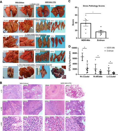 Fig. 5 MDR-Mtb induced typical lung TB pathology similar to the Erdman strain after a high-dose 500-CFU infection of nonhuman primates.a Representative digital images of the whole lung (panel 1), sections of the right caudal (panel 2), right middle (panel 3), and left caudal (panel 4) lung lobes and the hilar lymph nodes/liver (panel 5) from MDR-Mtb-infected and Erdman-Mtb-infected macaques are shown. Representative MDR-Mtb-infected and Erdman-Mtb-infected macaques with both severe and less severe TB lesions are displayed, with the ID number of the representative monkeys indicated in the upper-left corner. WPA11 served as a less severe example despite moribund related to an overreaction to a transient IL2 treatment. Note that the lung lobes of Erdman-Mtb-infected macaques were opened, whereas those of MDR-Mtb-infected animals were sliced to adhere to the more stringent safety protocols. TB lesions could be adjudged based on the examples indicated by the white arrows demonstrating the presence of caseation pneumonia or extensive coalescing granulomas and by the examples indicated by the small arrows demonstrating less coalescing or noncoalescing granulomas. The vertical/horizontal bars at the bottom left represent the 1-cm scale derived from the fluorescence rulers of each original photo, including the sliced sections. In panel 5, which shows the liver, enlarged views of granulomas from selected areas (blue arrows) are shown in the upper or lower corners. Lungs and other organs were obtained during the necropsies that occurred 2.5–4 months after infection with Mtb. b Representative histopathological images of both the severe and less severe TB lesions in representative MDR-Mtb-infected and Erdman-Mtb-infected macaques. H&E stained sections of typical tubercles in the right caudal lobes taken from two representative macaques from each group, with the macaque ID number and magnification indicated in each image. The severe TB lesions from the MDR-Mtb-infected macaque (WPA20) and the Erdman-Mtb-infected macaque (CN8333) are characterized by widespread necrosis and tissue destruction. Many polymorphic leukocytes, epithelioid cells, macrophages, and degenerative or necrotic cells are seen in the edges of the tubercles. There was insufficient infiltration of lymphocytes. The less severe TB lesions shared by the MDR-Mtb-infected macaque (WPA11) and Erdman-Mtb-infected macaque (CN8344) were generally characterized by less necrotic tubercles, which were mainly composed of epithelioid cells, giant cells, fibroblasts, and macrophages. There were notable infiltration zones of lymphocytes, plasma cells, and macrophages around the tubercles. Note the modest amount of inflammatory effusion seen in the alveoli near the tubercles. c Mean gross pathology scores ± SEM for MDR-Mtb-infected macaques (n = 6) and Erdman-Mtb-infected animals (n = 9). The scores were calculated as previously described. Differences between groups were analyzed, but we cannot claim any biological significance due to the existence of different endpoints. In this study, we intended to assess the similarity of MDR TB to DS TB rather than to compare the extent/severity. Most MDR-Mtb-infected macaques received adalimumab near the endpoint. Erdman-Mtb-infected macaques were euthanized ~1–2 months earlier than MDR-Mtb-infected macaques due to budget constraints. d High levels of MDR-Mtb burdens in the lungs are associated with the pathology of MDR-TB. The CFU counts per gram equivalent to a milliliter of lung tissue homogenates of the right (Rt) caudal, right middle, and lower left lung lobes collected at the endpoints are shown. To estimate the lung infection levels, the CFUs of MDR-Mtb in lung lobes at the endpoint (at ~4.5 months) were aligned with those of Erdman-Mtb in lung lobes at 2–3 months. We conducted a statistical analysis to estimate the differences, but we cannot claim any biological significance due to the existence of different endpoints and other factors such as adalimumab (Supplementary Figure)