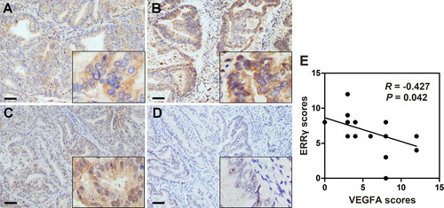 Figure 1. Negative association between ERRγ and VEGFA expression in human endometrial cancer tissue specimens. A–B, Representative immunohistochemical staining for ERRγ in EC tissues with low (A) and high (B) intensity. C–D, Immunohistochemical staining for VEGFA in the same areas of ERRγ (Original magnification: 400 × for the inserts, 100 × for all others; scale bar, 50 μm). E, Histological scores of ERRγ and VEGFA in the 23 EC specimens. ERRγ, estrogen receptor-related receptor γ; VEGFA, vascular endothelial growth factor A; EC, endometrial cancer.