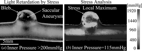 Figure 5 (a) Photoelastic image of saccular aneurysm with bleb. (b) Stress analysis for saccular aneurysm model with bleb and inner pressure of 115 mmHg.