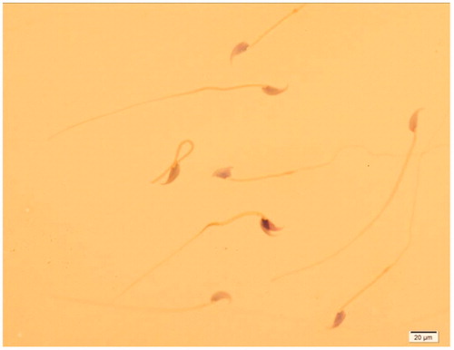 Figure 3. Different types of sperm shape abnormality in FA group vs. control group. Sperm suspension was smeared onto glass slides and stained using the method of Papanicolaou. Spermatozoa were counted and categorized as normal, head abnormal, neck abnormal and tail abnormal spermatozoa, ×100 magnification.