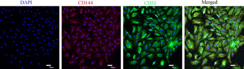 Figure 3. Identification surface markers of vascular endothelial cells, the expression of CD31 (FITC, green) and CD144 (Cy5, red) were detected using immunofluorescence.