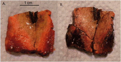 Figure 8. Macroscopic resection of ablation zone showing fresh tissue (A) and NADH-stained tissue with black staining demonstrating viability (B). The absence of staining with the white zone of the ablation site confirms lack of tissue viability. There is some staining within the red zone, and so ablation size was calculated on the size of the white zone (white arrow).