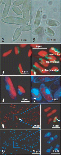 Figs. 2–9. Light and fluorescence micrographs of Koliella antarctica cells cultured in continuous light or in complete darkness for 60 days. Fig. 2. Spindle-shaped light grown cells, mostly organized in pairs. Fig. 3. Green-fluorescent elongated mitochondrion after Rh123 staining and red-fluorescent chloroplast in light-grown cells (excitation = 436 nm). Fig. 4. Uniform light-blue DAPI staining of the nucleus in light-grown cells (excitation = 365 nm). Fig. 5. Cells cultured in darkness for 60 days. Fig. 6. After 60 days darkness, Rh123-stained mitochondria show three different typologies. Fig. 7. After 60 days darkness, DAPI shows chromatin condensed in a ring. Fig. 8. TUNEL-test indicates DNA-fragmentation only in 1–2% of cell population: only one positive reaction (picture on the right), visualized by green fluorescence of FITC, is detected in the field (arrow). Fig. 9. Hoechst DNA counterstaining performed on the same cells as in Fig. 8 shows the chromatin condensed in a ring.
