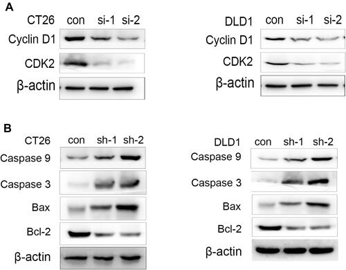 Figure 4 The regulation of some apoptotic marker in CT26 and DLD1 cells by ACAT2 knockdown. (A) The expression of cyclin D1 and CDK2 in CT26 or CT26 cells transfected with siRNA-ACAT2 (DLD1 or DLD1 cells transfected with siRNA-ACAT2). (B) The expression of caspase 3, caspase 9, Bcl-2 and Bax in CT26 or CT26 cells transfected with siRNA-ACAT2 (DLD1 or DLD1 cells transfected with siRNA-ACAT2).