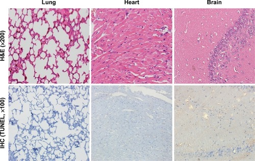 Figure 8 Toxicity assessment of the main tissues after different AMB formulation treatments.Notes: Macroscopic appearance of histological H&E and apoptosis marker TUNEL immunohistochemical stains. Histopathological examination of the mice lung/heart/brain detected no obvious pathological changes or cell apoptosis after OX26-AMB-NP (equivalent free AMB, 1 mg/kg) treatment for 48 hours.Abbreviations: AMB, amphotericin B; H&E, hematoxylin and eosin stain; IHC, immunohistochemistry; NP, nanoparticle; OX26, TfR monoclonal antibody of rats; TfR, transferrin receptor; TUNEL, terminal deoxynucleotidyl transferase-mediated dUTP-biotin nick end labeling assay.