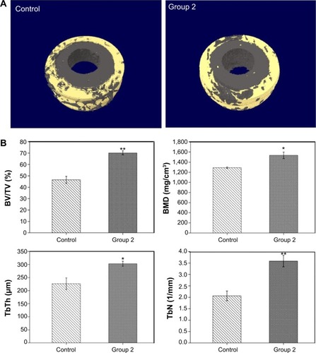 Figure 10 Micro-CT reconstruction models and micro-CT results after 8 weeks of implantation.Notes: (A) Micro-CT 3D reconstruction models showing regeneration of microstructures about 0.5 mm in thickness bonding to polished and microrough PEEK/n-HA/CF implants at 8 weeks. (B) Micro-CT results containing the percent of BV/TV, BMD, TbTh, and TbN after 8 weeks of implantation. *P<0.05 compared to the control group. **P<0.01 compared to the control group.Abbreviations: BV/TV, bone volume/tissue volume; BMD, bone mineral density; TbTh, trabecular thickness; TbN, trabecular number; CT, computed tomography; 3D, three-dimensional; PEEK/n-HA/CF, carbon fiber-reinforced polyetheretherketone–nanohydroxyapatite.