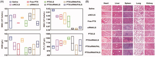 Figure 9. (A) Effects of different nanoparticles on hematology of mice were analyzed by SYSMEX XE-2100 Hematology Analyzer and expressed by the floating bars (min to max). Representative hematology markers were analyzed including assessment of white blood cell counts (WBC), red blood cell counts (RBC), hemoglobin (HGB), and platelet counts (PLT). (B) Histological analysis of organs extracted from tumor-bearing mice. Effects of co-delivery nanoparticles on the histopathology of mice organs in toxicity tests. Organ samples were embedded in paraffin, and sections were stained with H&E and viewed under a light microscope at 200× magnification.