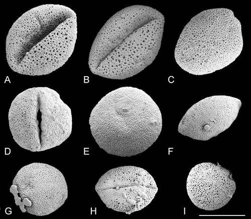 Figure 5. SEM, pollen grains ofTrithuria spp. from northern Australia. A–E. Species with bisexual reproductive units. F–I. Dioecious species. (A–C) T. lanterna (Egan 4816 & Knox); (D, E) T. cowieana (Cowie & Jacka 9995); (F, G) T. cookeana; (H, I) T. polybracteata. Scale bar common to all images – 10 µm.