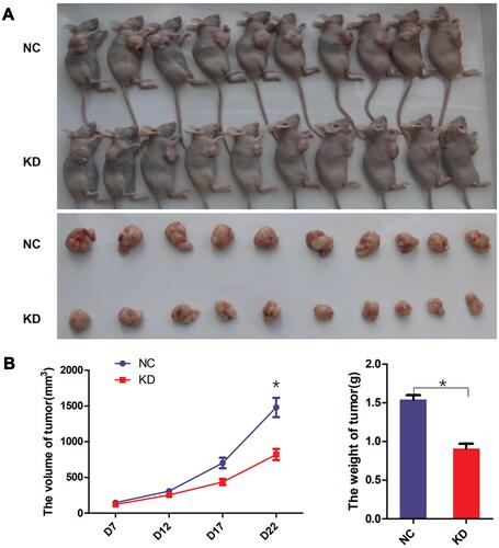 Figure 5 TRAPPC5 knockdown repressed tumor growth in vivo. (A, B) Stable HCCLM3 cells (1 × 106 /mouse) were hypodermically inoculated into the right flanks of the mice. Tumor volume was estimated every week. Three weeks later, the mice sacrificed to collect tumor tissues and weighed. *P < 0.05.