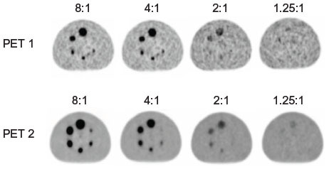 Figure 1 PET images of the National Electrical Manufacturers Association 2001 International Electrotechnical Commission Body phantoms.