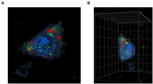 Figure 7 Live cell imaging using holotomography of A375 cells treated with Mel-loaded NISVs from F2. (A) XY image and (B) 3D rendered holotomographs of FITC-labeled Mel (green) loaded into niosomes. The formulation was labeled with lipophilic NR (red) for 4 hours. The cellular nuclei were counterstained by DAPI (blue).